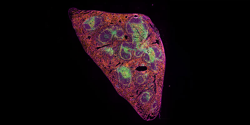 launch-zeiss-axioscan-7-spatial-biology-provides