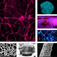 3D Cell Based imaging for Drug Discovery