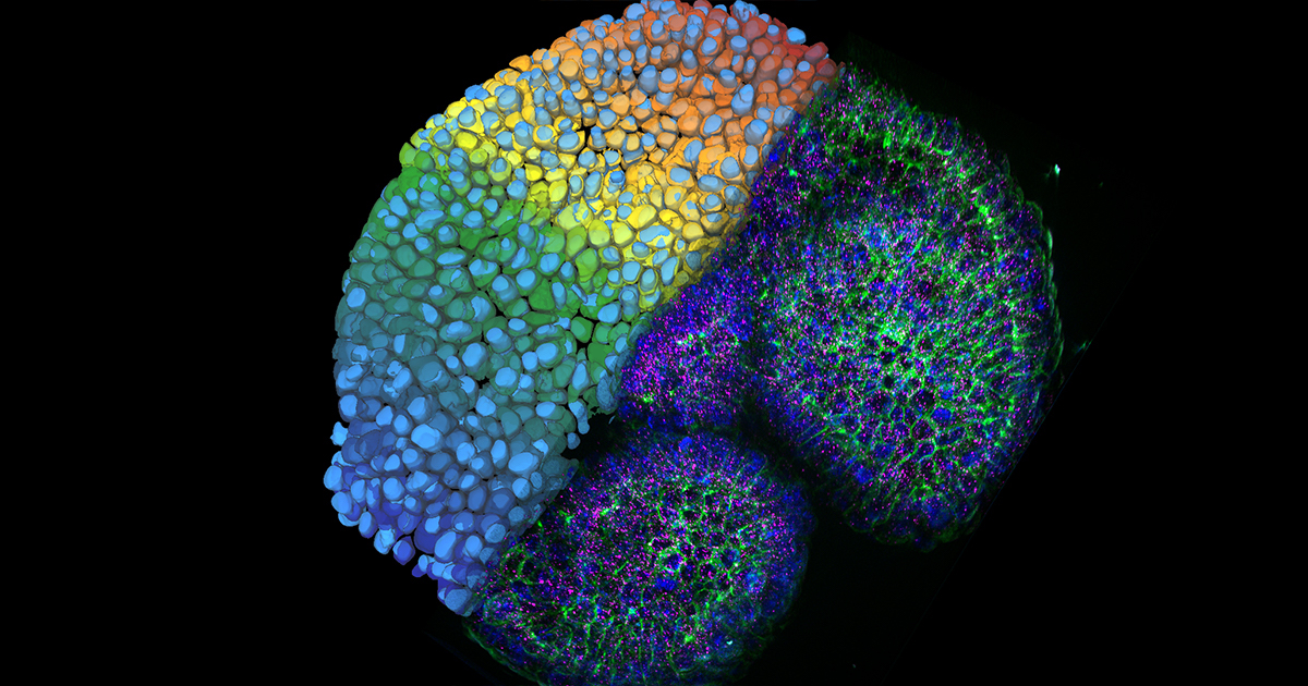 Intestine organoid with nuclei (DAPI, blue), plasma membrane (green), and smFISH probe (magenta) labeling imaged with a THUNDER 3D tissue imager system and analyzed with Aivia’s new integrated Cellpose and 3D Cell Analysis recipe.