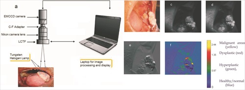 Diffuse Reflectance imaging set-up and image processing
