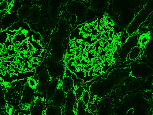 Immunofluorescence staining on human kidney sections using JM403 Heparan Sulfate antibody