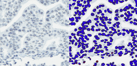 Leica Microsystems and Indica Labs Announce Availability of Integrated Advanced Digital Pathology Image Analysis