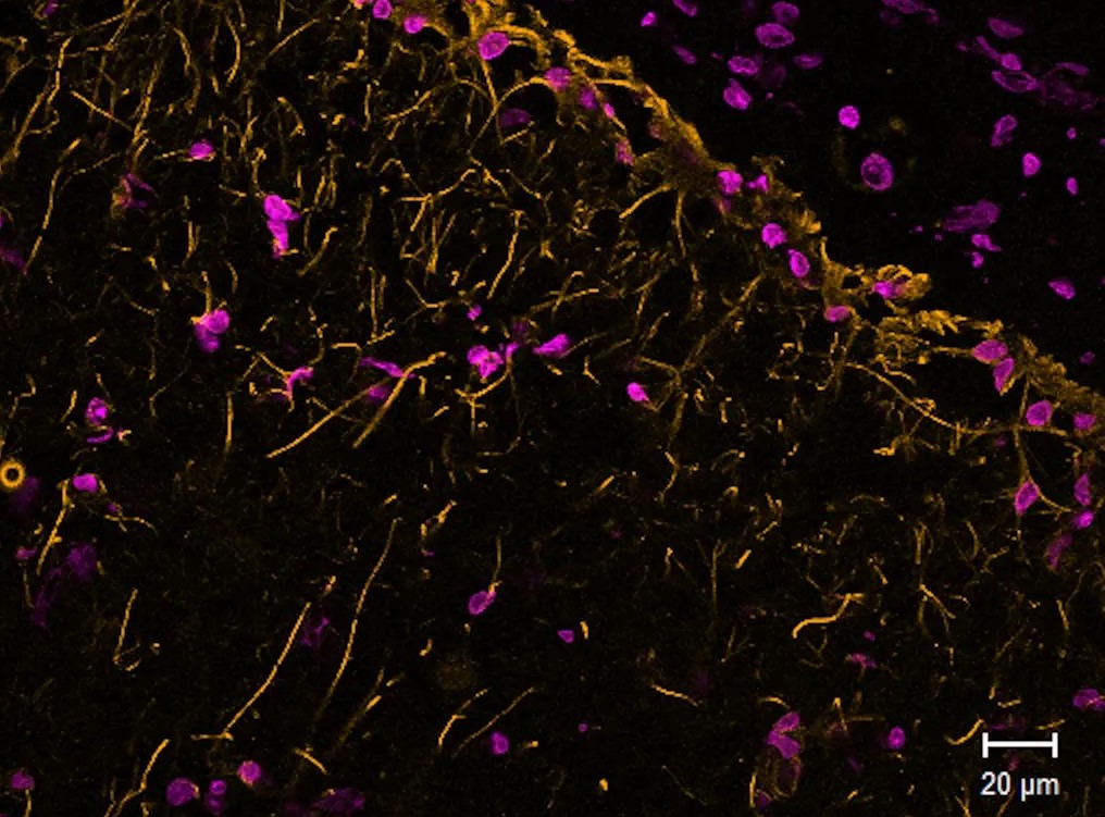 biotiums-new-minimab-singledomain-antibody-series