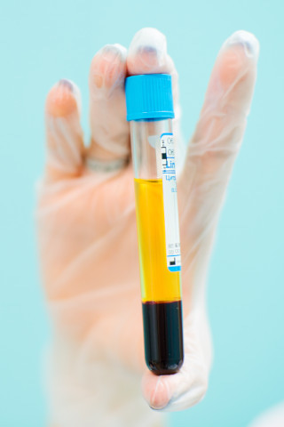 ymc-application-note-lcmsms-analysis-pfas-human-serum