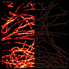 PAL-M image (right) and TIRF image (left) of antibody staining for tubulin in a cultured cell. Specimen: S. Niwa, University of Tokyo, Japan.