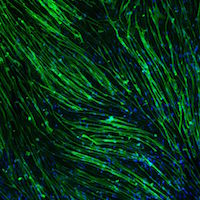 Scalable Protocol to Differentiate Skeletal Muscle Cells from Stem Cells