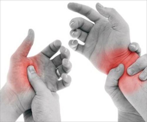  Repetitive Strain Injuries