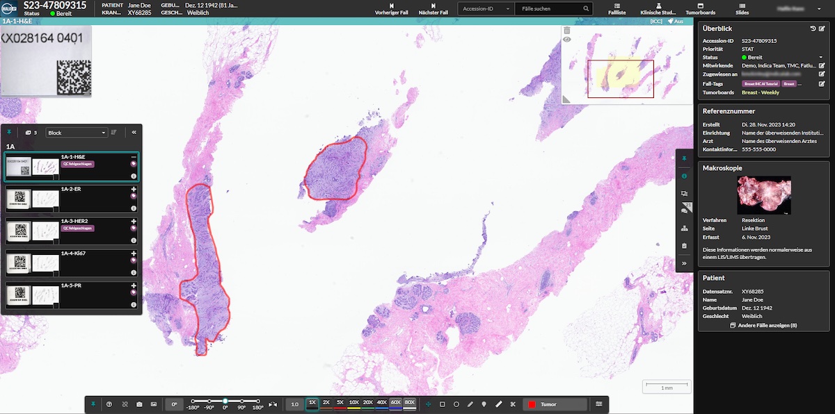 indica-labs-digital-pathology-platform-chosen-the