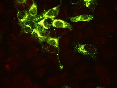 ViroStat - New Hantavirus Monoclonal Antibodies