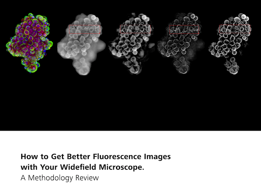 how-get-better-images-your-widefield-microscope
