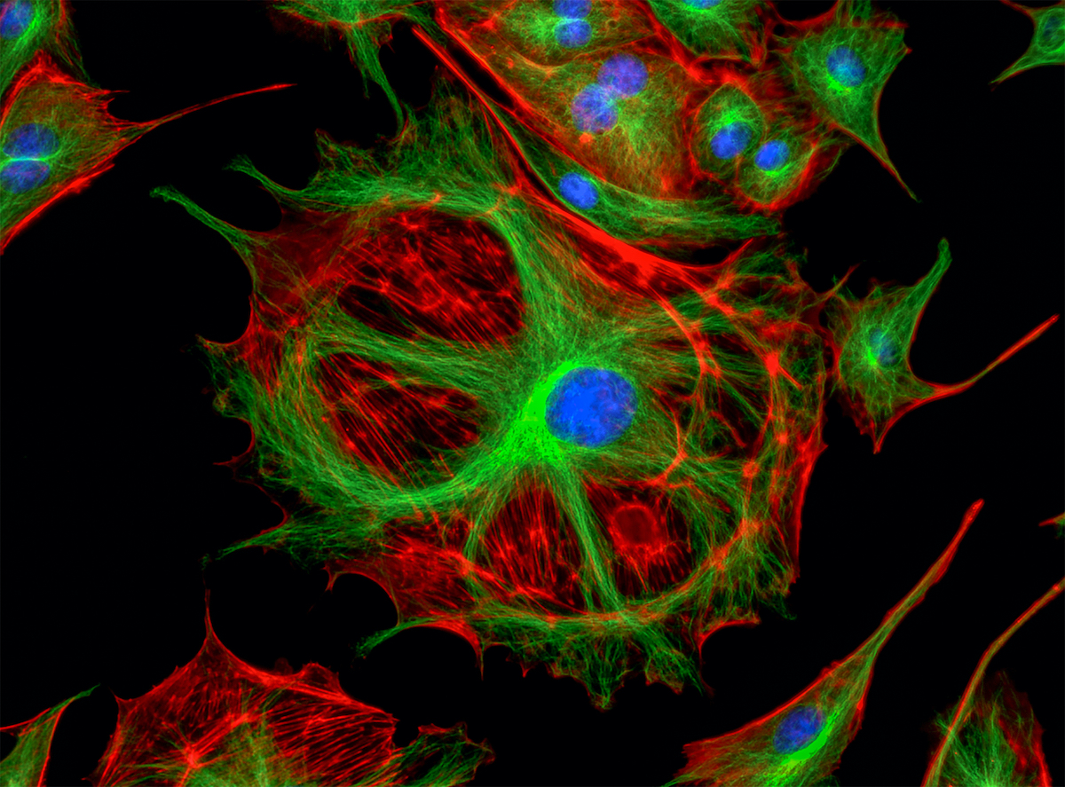 transporting-proteins-directly-into-living-cells