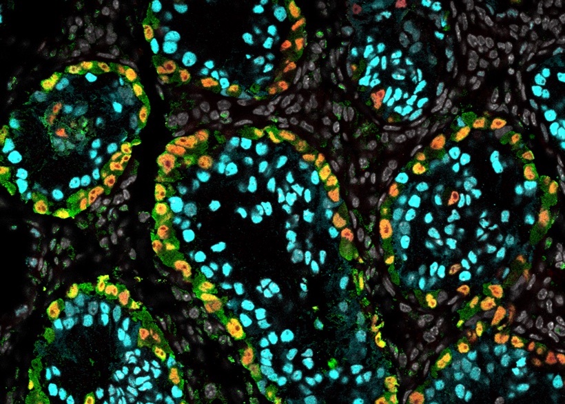 ipsc-protocol-opens-the-door-explore-male-infertility