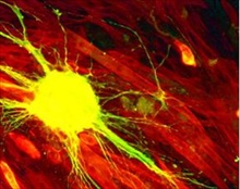 Stem Cells in Neuroscience Research