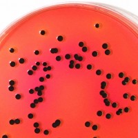 Specific Salmonella detection with Lab M’s new XLT4 Agar for effective ...