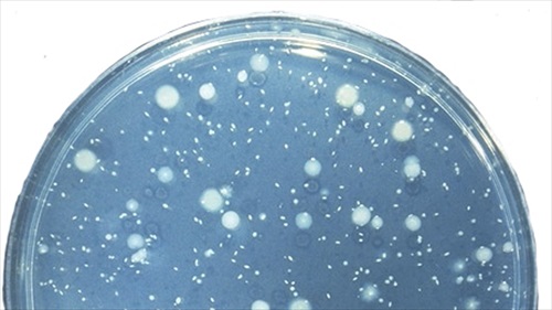 Lab M R2A Medium for heterotrophic bacteria in water