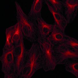 Tubulin. Multiphoton excitation of Atto 647N at 1200nm.