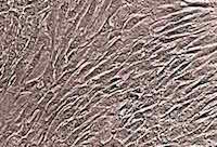 human mesenchymal stem cells