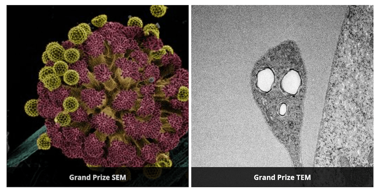 jeol-announces-2020-microscopy-image-grand-prize