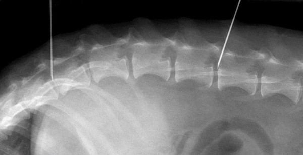 Embedded Chondroitinase ABC Shows Promise for Spinal Injury Treatment